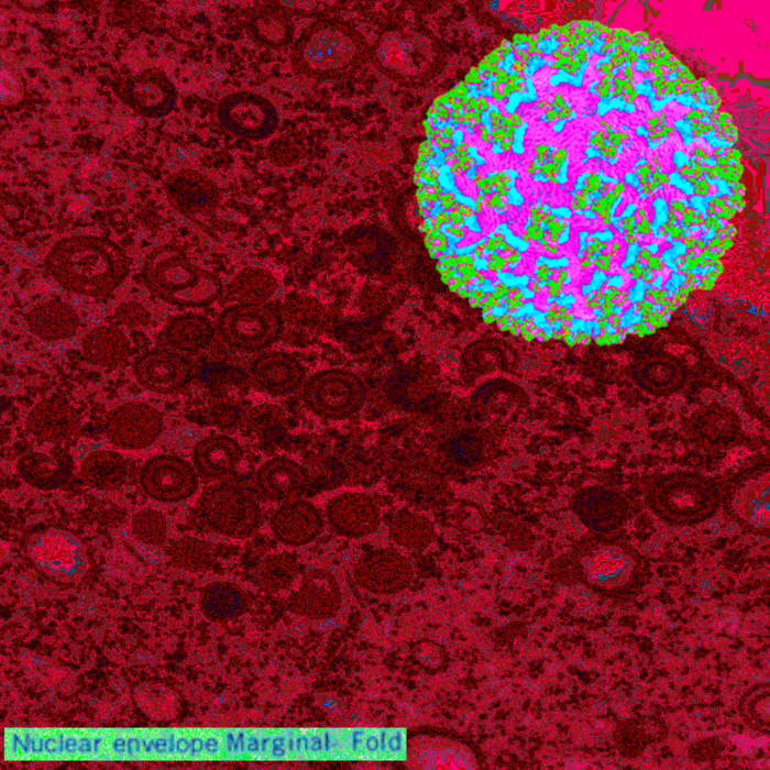 Cover art for Nuclear Envelope Marginal Fold